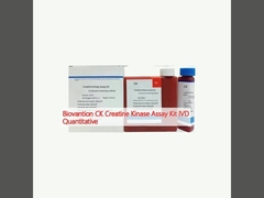 Biovantion CK ক্রেটিন কিনেজ অ্যাসে কিট IVD Quantitative