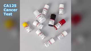 ক্যান্সার পর্যবেক্ষণের জন্য CA125 ELISA পরীক্ষা