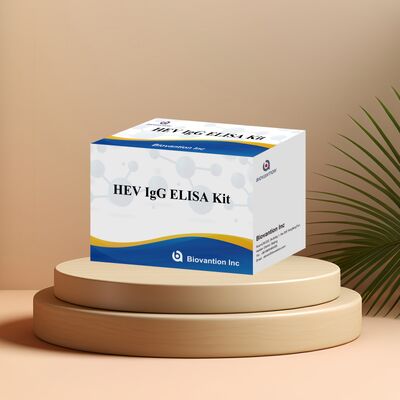 হেপাটাইটিস ই নির্ণয়ের জন্য ৯৬টি টেস্ট এবং ১৮ মাসের মেয়াদ সহ উচ্চ সংবেদনশীলতা সম্পন্ন HEV-IgG ELISA টেস্ট কিট
