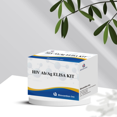 Biovantion 4th Generation HIV Ab Ag ELISA Kit with High Sensitivity and 96 Tests for Early Detection Biovantion 4th Generation HIV Ab Ag ELISA Kit with High Sensitivity and 96 Tests for Early Detection Biovantion 4th Generation HIV Ab Ag ELISA Kit with High Sensitivity and 96 Tests for Early Detection Biovantion 4র্থ প্রজন্মের এইচআইভি এব এজ এলিসা কিট উচ্চ সংবেদনশীলতা এবং 96 টি পরীক্ষার সাথে প্রাথমিক সনাক্তকরণের জন্য