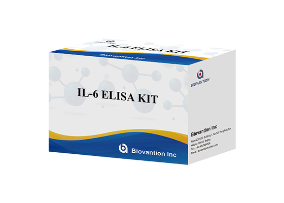 রাট IL-21 RAT IL-21 FOR RESEARCH USE ONLY সিরাম নমুনা টাইপ 96 নির্ধারণ