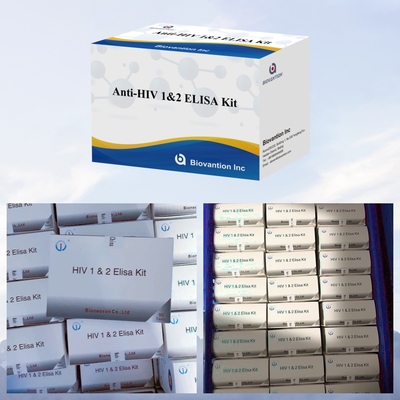 Biovantion এন্টি-এইচআইভি ELISA টেস্ট কিট 18 মাস HIV-1 এবং HIV-2 টেস্টের জন্য শেল্ফ জীবনকাল