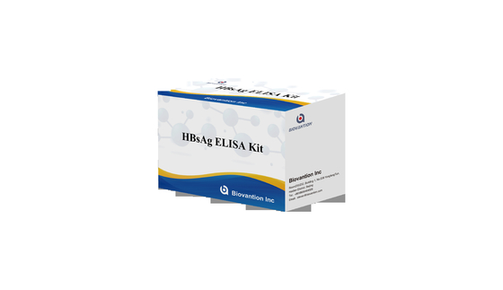 HBsAg ELISA টেস্ট কিট HBsAg ভাইরাসের গুণগত নির্ধারণ