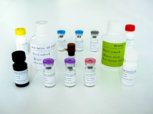 সিরাম প্লাজমা টিবি-আইজিআরএ