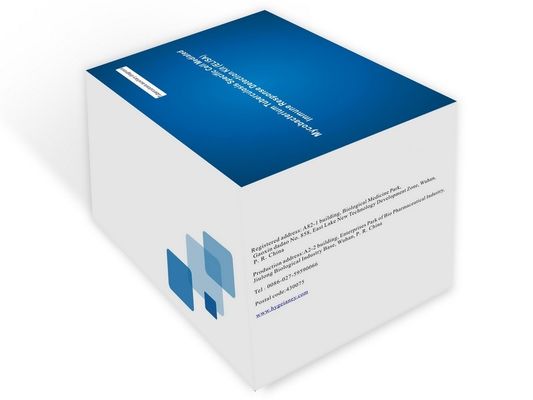 সিরাম প্লাজমা টিবি-আইজিআরএ