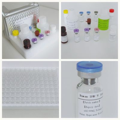 সিরাম প্লাজমা টিবি-আইজিআরএ