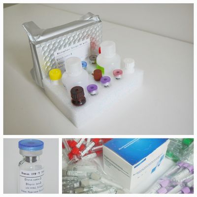 সিরাম প্লাজমা টিবি-আইজিআরএ