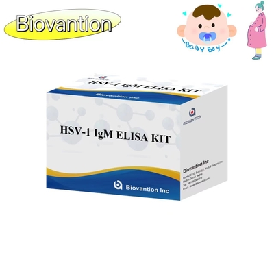 টর্চ এলআইএসএ টেস্ট কিট HSV 1 IgM উচ্চ গরম বিক্রয় ডায়াগনস্টিক রিএজেন্ট IVD