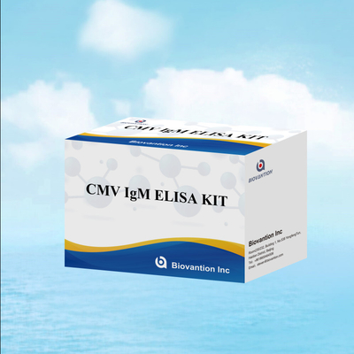 ম্যাক্রোফেজ আইজিএম গুণগত ELISA পরীক্ষা IVD পরীক্ষামূলক কিট উচ্চ সংবেদনশীল