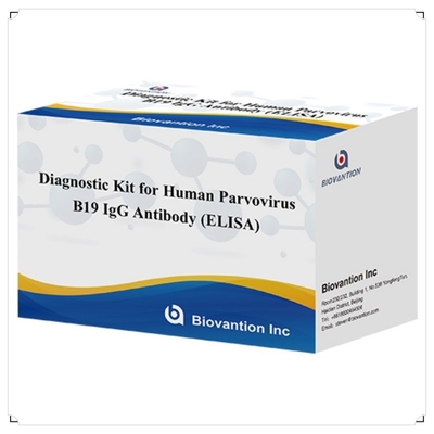 কারখানার সরাসরি বিক্রয় B19 ELISA কিট মানব পারভোভাইরাস B19 IgM অ্যান্টিবডি Elisa টেস্ট কিট 96T সঙ্গে