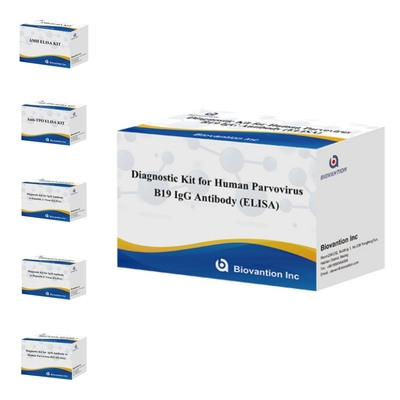 কারখানার সরাসরি বিক্রয় B19 ELISA কিট মানব পারভোভাইরাস B19 IgM অ্যান্টিবডি Elisa টেস্ট কিট 96T সঙ্গে