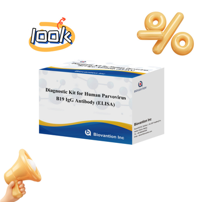 কারখানার সরাসরি বিক্রয় B19 ELISA কিট মানব পারভোভাইরাস B19 IgM অ্যান্টিবডি Elisa টেস্ট কিট 96T সঙ্গে