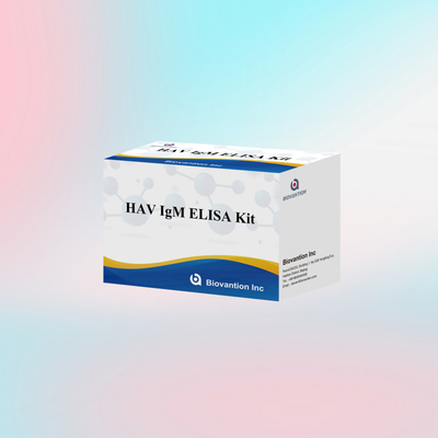 HAV IgM ELISA Kit উচ্চ সংবেদনশীলতা হেপাটাইটিস এ ভাইরাস সনাক্তকরণ ক্লিনিকাল পরীক্ষাগারগুলির জন্য নির্ভরযোগ্য সঠিক ডায়াগনস্টিক পরীক্ষা