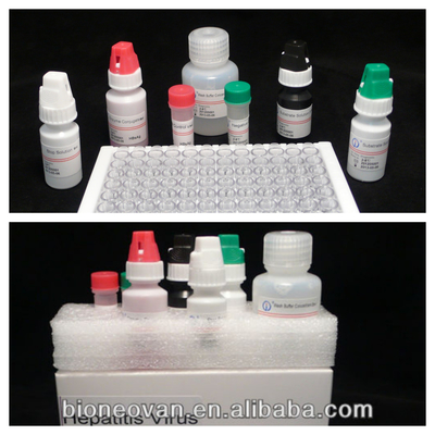 HBsAg ELISA টেস্ট কিট HBsAg ভাইরাসের গুণগত নির্ধারণ