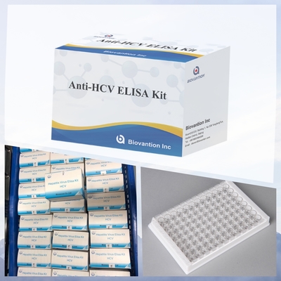 মানব ডায়াগনস্টিক ব্যবহারের জন্য নতুন আগমন IVD HCV ELISA টেস্ট কিট হাসপাতাল ক্লিনিক ল্যাব