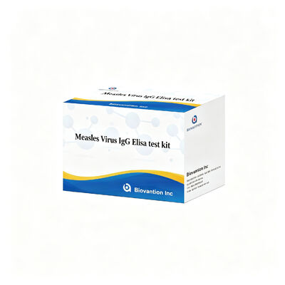 হামের ভাইরাস IgG ELISA টেস্ট কিট উচ্চ সংবেদনশীলতা নির্দিষ্টতা