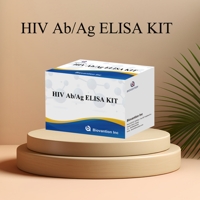 Biovantion 4th Generation HIV Ab Ag ELISA Kit with High Sensitivity and 96 Tests for Early Detection Biovantion 4th Generation HIV Ab Ag ELISA Kit with High Sensitivity and 96 Tests for Early Detection Biovantion 4th Generation HIV Ab Ag ELISA Kit with High Sensitivity and 96 Tests for Early Detection Biovantion 4র্থ প্রজন্মের এইচআইভি এব এজ এলিসা কিট উচ্চ সংবেদনশীলতা এবং 96 টি পরীক্ষার সাথে প্রাথমিক সনাক্তকরণের জন্য