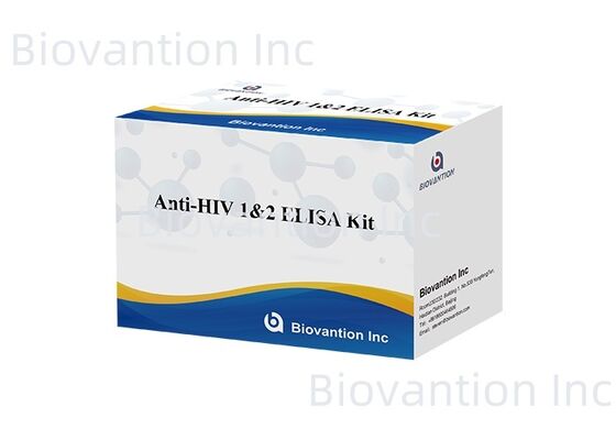 HIV 1/2 ELISA টেস্ট কিট 96T হিউম্যান ইমিউনোডিফিসিয়েন্সি ভাইরাস অ্যান্টিবডি সনাক্তকরণ